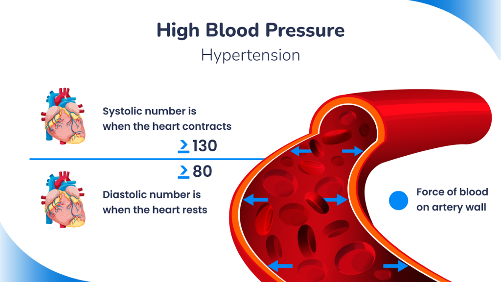 What Is Blood Pressure? 