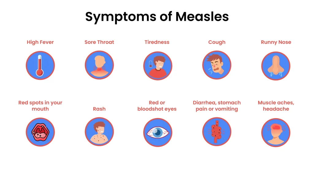 Symptoms of Measles