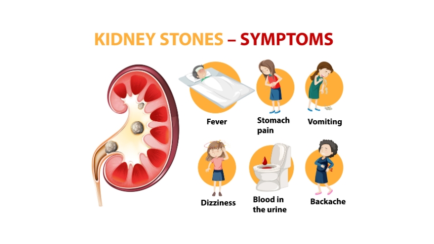 Struvite kidney stones caused by infection