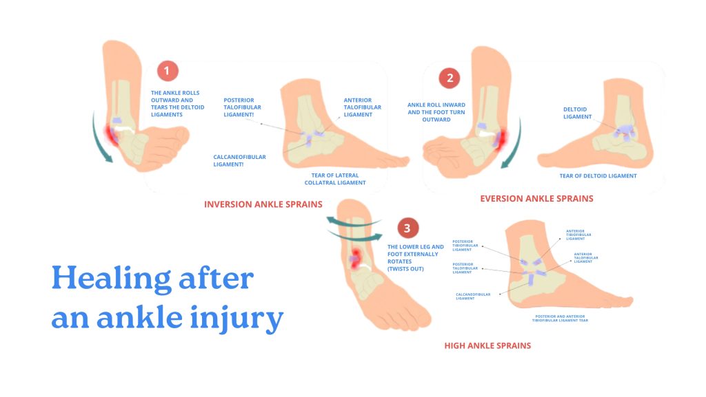 ankle ligament healing process and recovery stages